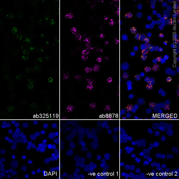 Immunocytochemistry/ Immunofluorescence - Goat Anti-Rat IgG H&L (Alexa Fluor® 594) (AB150160)