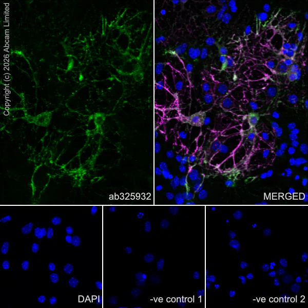 Immunocytochemistry/ Immunofluorescence - Goat Anti-Rat IgG H&L (Alexa Fluor® 594) (AB150160)