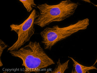 Immunocytochemistry/ Immunofluorescence - Goat Anti-Rat IgG H&L (Alexa Fluor® 594) preadsorbed (AB150168), expandable thumbnail