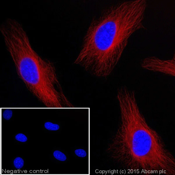 Immunocytochemistry/ Immunofluorescence - Goat Anti-Rat IgG H&L (Alexa Fluor® 647) (AB150159)