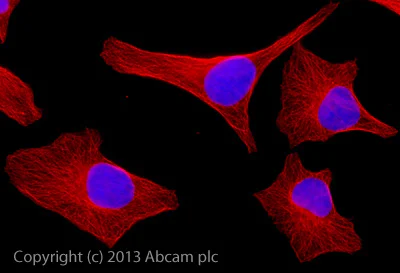 ahpl A.H.P.L アンドッパーレアCOLOR adidas Aloha Super “One Black Eye” HQ2032 | Nice Kicks