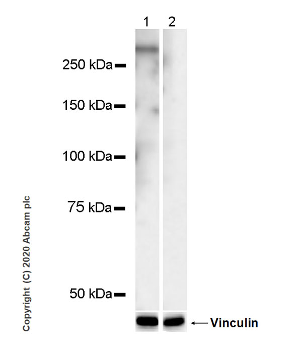 Western blot - Goat Anti-Rat IgG H&L (HRP) (ab205720), expandable thumbnail
