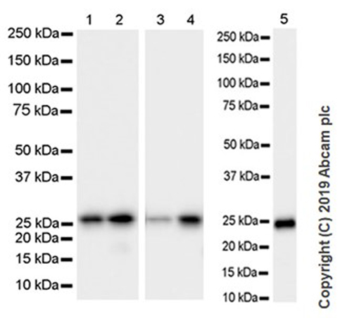 Western blot - Goat Anti-Rat IgG H&L (HRP) (ab205720), expandable thumbnail