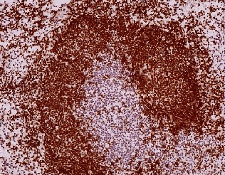 Immunohistochemistry (Formalin/PFA-fixed paraffin-embedded sections) - Goat Anti-Rat IgG H&L (HRP polymer) (AB214882), expandable thumbnail