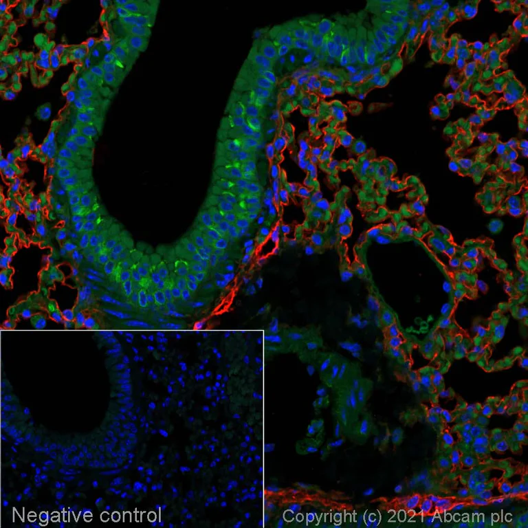 Immunohistochemistry (Formalin/PFA-fixed paraffin-embedded sections) - Goat Anti-Syrian hamster IgG H&L (Alexa Fluor® 647) (AB180117)