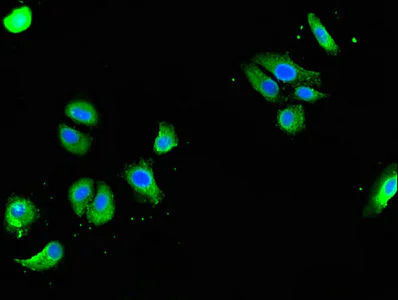 Immunocytochemistry/ Immunofluorescence - Anti-GOLGA3 antibody (AB223043)