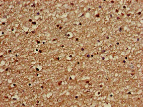 Immunohistochemistry (Formalin/PFA-fixed paraffin-embedded sections) - Anti-GOLGA3 antibody (AB223043)