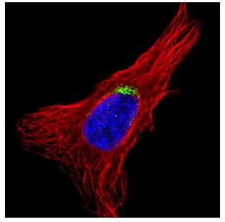 Immunocytochemistry/ Immunofluorescence - Anti-GOLGA5/Golgin-84 antibody (AB155806)