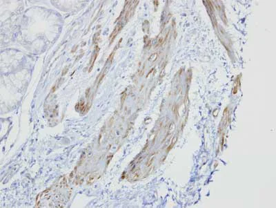 Immunohistochemistry (Formalin/PFA-fixed paraffin-embedded sections) - Anti-GOLGA5/Golgin-84 antibody (AB155806)