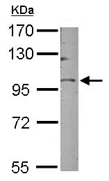 Western blot - Anti-GOLGA5/Golgin-84 antibody (AB155806)