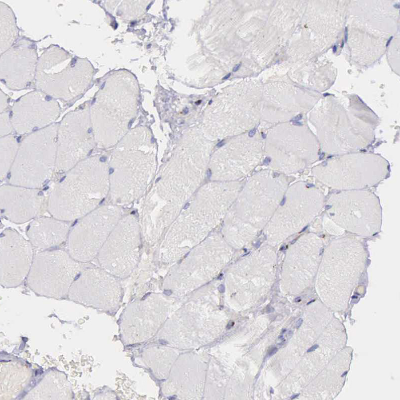Immunohistochemistry (Formalin/PFA-fixed paraffin-embedded sections) - Anti-GOLGA5/Golgin-84 antibody (ab224040), expandable thumbnail