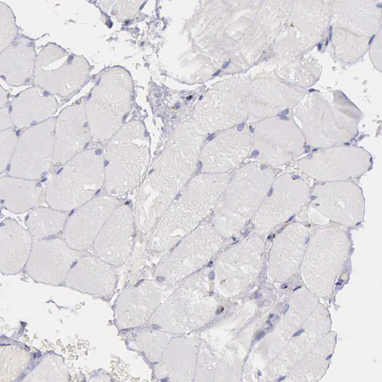 Immunohistochemistry (Formalin/PFA-fixed paraffin-embedded sections) - Anti-GOLGA5/Golgin-84 antibody (AB224040)