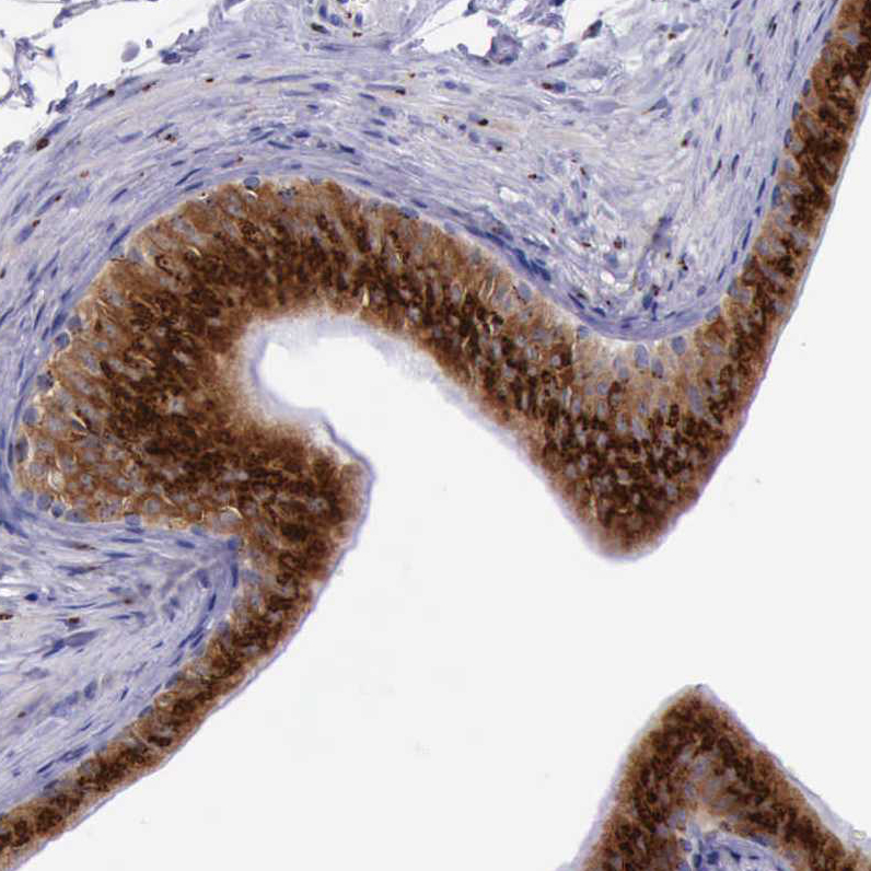 Immunohistochemistry (Formalin/PFA-fixed paraffin-embedded sections) - Anti-GOLGA5/Golgin-84 antibody (AB224040), expandable thumbnail