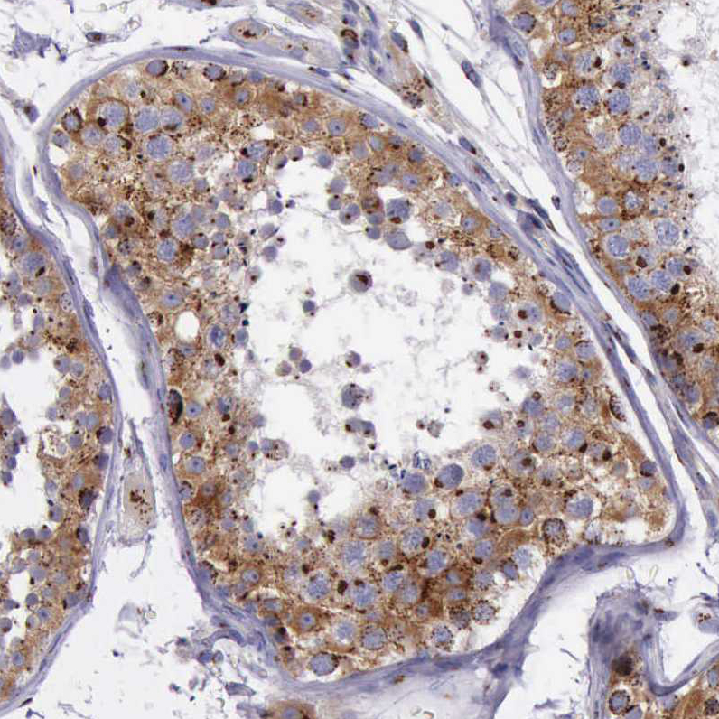 Immunohistochemistry (Formalin/PFA-fixed paraffin-embedded sections) - Anti-GOLGA5/Golgin-84 antibody (AB224040), expandable thumbnail