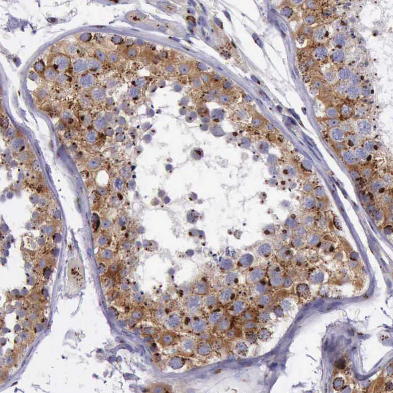 Immunohistochemistry (Formalin/PFA-fixed paraffin-embedded sections) - Anti-GOLGA5/Golgin-84 antibody (AB224040)