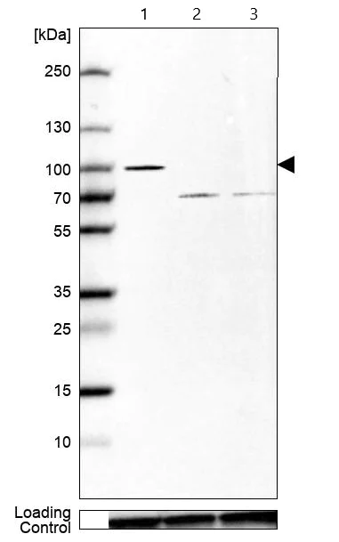 Western blot - Anti-GOLGA5/Golgin-84 antibody (AB224040)