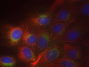 Fluorescence Microscopy - Golgi/ER Staining Kit - Cytopainter (AB139485)