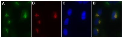 Fluorescence Microscopy - Golgi Staining Kit - Green Fluorescence - Cytopainter (AB139483), expandable thumbnail