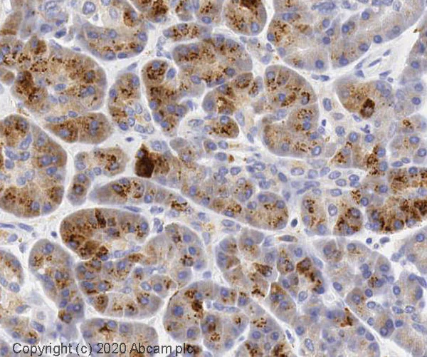 Immunohistochemistry (Formalin/PFA-fixed paraffin-embedded sections) - Anti-Golgin 97 antibody (AB84340)