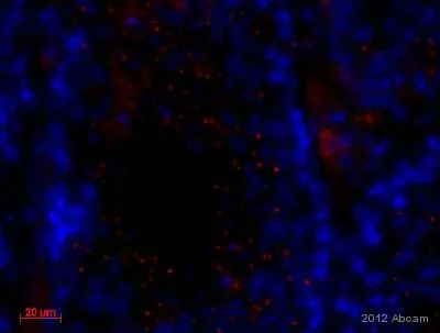 Immunohistochemistry (Formalin/PFA-fixed paraffin-embedded sections) - Anti-Golgin 97 antibody (AB84340)