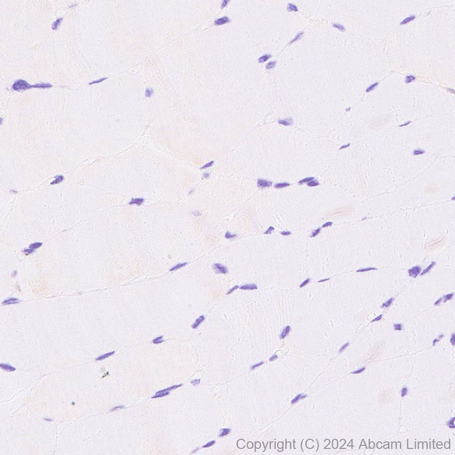 Immunohistochemistry (Formalin/PFA-fixed paraffin-embedded sections) - Anti-GOLM1/GOLPH2 antibody [EPR29022-61] (AB320737)