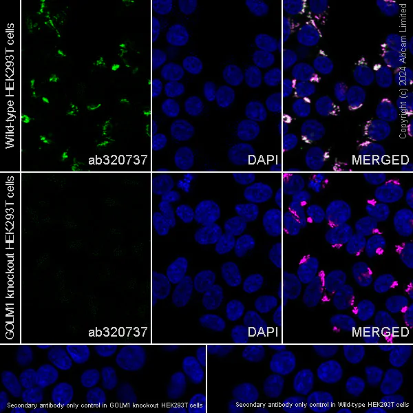 Immunocytochemistry/ Immunofluorescence - Anti-GOLM1/GOLPH2 antibody [EPR29022-61] - BSA and Azide free (AB320738)