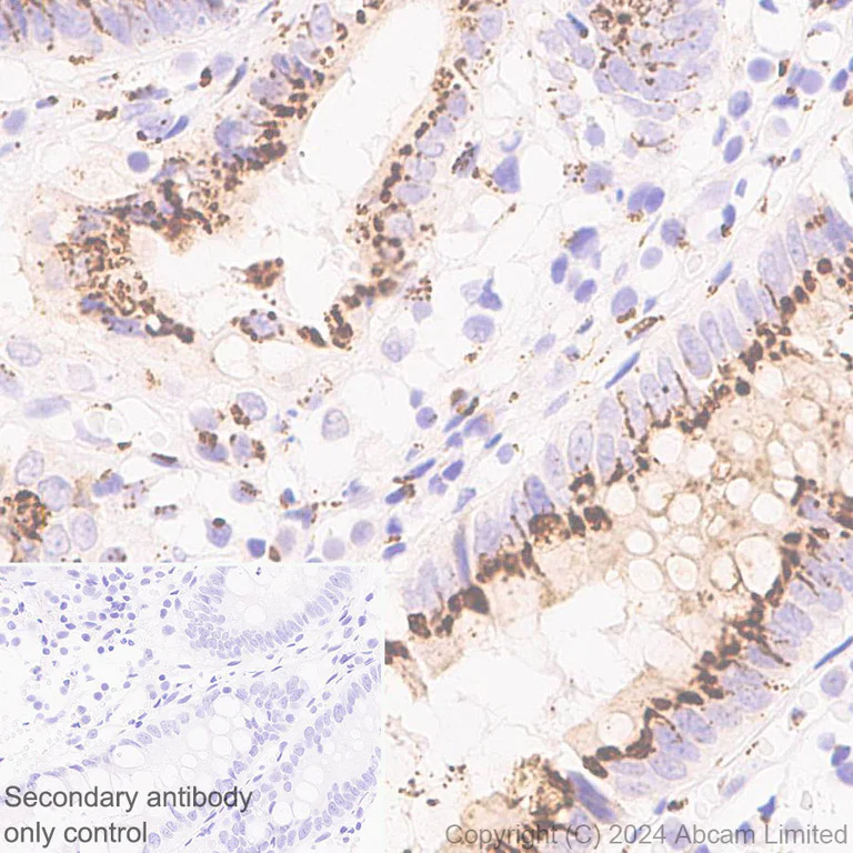 Immunohistochemistry (Formalin/PFA-fixed paraffin-embedded sections) - Anti-GOLM1/GOLPH2 antibody [EPR29022-61] - BSA and Azide free (AB320738)