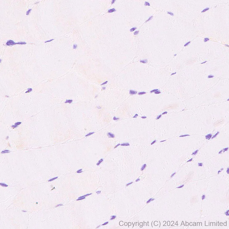 Immunohistochemistry (Formalin/PFA-fixed paraffin-embedded sections) - Anti-GOLM1/GOLPH2 antibody [EPR29022-61] - BSA and Azide free (AB320738)