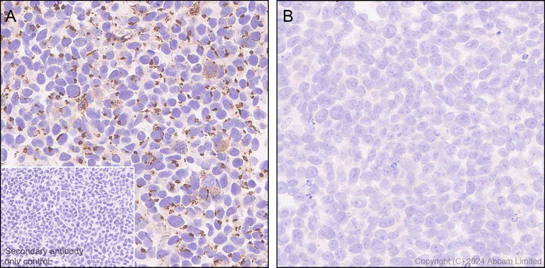 Immunohistochemistry (Formalin/PFA-fixed paraffin-embedded sections) - Anti-GOLM1/GOLPH2 antibody [EPR29022-61] - BSA and Azide free (AB320738)