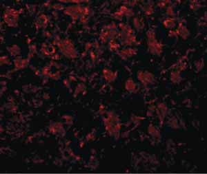 Immunocytochemistry/ Immunofluorescence - Anti-GOLPH2 antibody (AB92612)