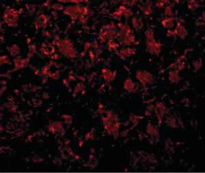 Immunocytochemistry/ Immunofluorescence - Anti-GOLPH2 antibody (AB92612)