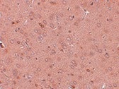 Immunohistochemistry (Formalin/PFA-fixed paraffin-embedded sections) - Anti-GOLPH2 antibody (AB92612)