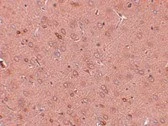Immunohistochemistry (Formalin/PFA-fixed paraffin-embedded sections) - Anti-GOLPH2 antibody (AB92612)