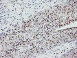 Immunohistochemistry (Formalin/PFA-fixed paraffin-embedded sections) - Anti-GOLPH2 antibody [OTI6C9] (AB119800)