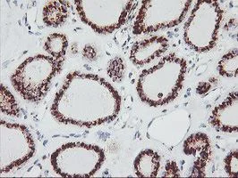 Immunohistochemistry (Formalin/PFA-fixed paraffin-embedded sections) - Anti-GOLPH2 antibody [OTI6C9] (AB119800)
