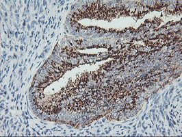 Immunohistochemistry (Formalin/PFA-fixed paraffin-embedded sections) - Anti-GOLPH2 antibody [OTI6C9] (AB119800)