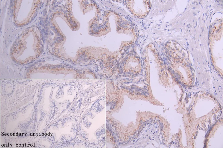 Immunohistochemistry (Formalin/PFA-fixed paraffin-embedded sections) - Anti-GOLPH3/MIDAS antibody (AB236296)