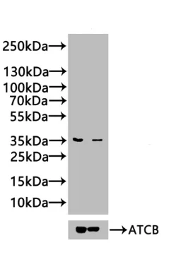Western blot - Anti-GOLPH3/MIDAS antibody (AB236296)