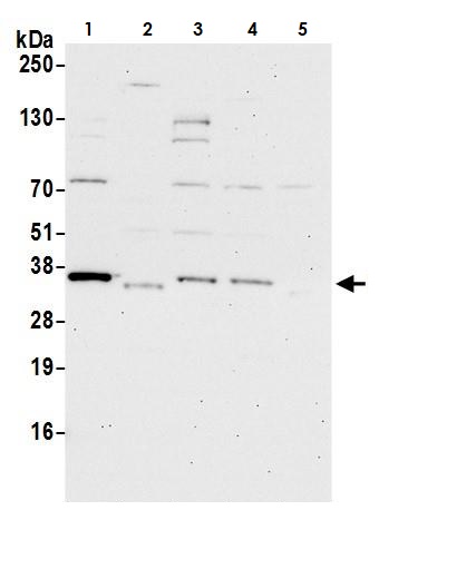 Western blot - Anti-GOLPH3/MIDAS antibody (AB264406), expandable thumbnail