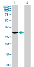 Western blot - Anti-GOLPH3/MIDAS antibody (AB69171)