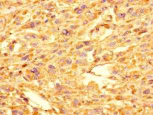 Immunohistochemistry (Formalin/PFA-fixed paraffin-embedded sections) - Anti-GOLPH3L antibody (AB238876)