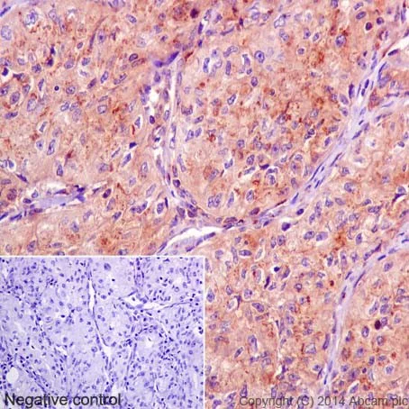 Immunohistochemistry (Formalin/PFA-fixed paraffin-embedded sections) - Anti-GOLPH4/GPP130 antibody [EPR13439] (AB197595)