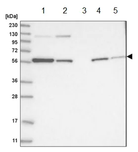 Western blot - Anti-GORASP2/GRASP55 antibody (AB204335)