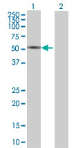 Western blot - Anti-GORASP2/GRASP55 antibody (AB68713), expandable thumbnail