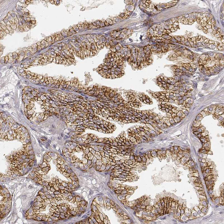 Immunohistochemistry (Formalin/PFA-fixed paraffin-embedded sections) - Anti-GORASP2/GRASP55 antibody [CL2610] (AB211532)