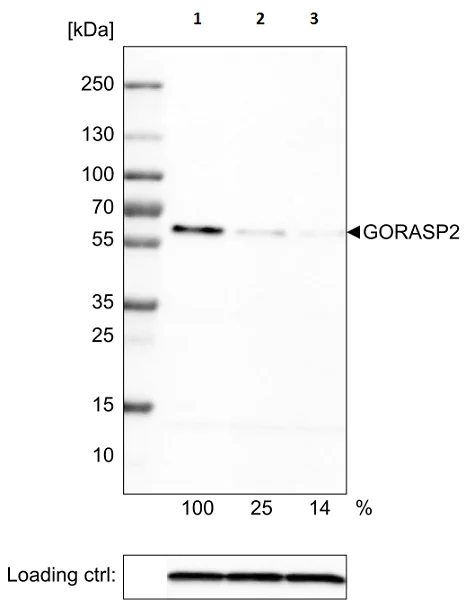 Western blot - Anti-GORASP2/GRASP55 antibody [CL2610] (AB211532)