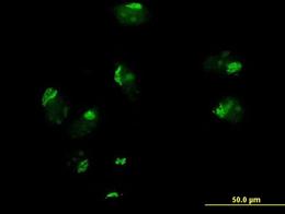 Immunocytochemistry/ Immunofluorescence - Anti-GOSR1/GS28 antibody (AB88462)
