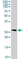 Western blot - Anti-GOSR1/GS28 antibody (AB88462)