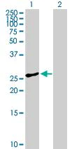 Western blot - Anti-GOSR1/GS28 antibody (AB88462)