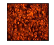Immunocytochemistry/ Immunofluorescence - Anti-GOSR1/GS28 antibody [EP1768Y] (AB53288)